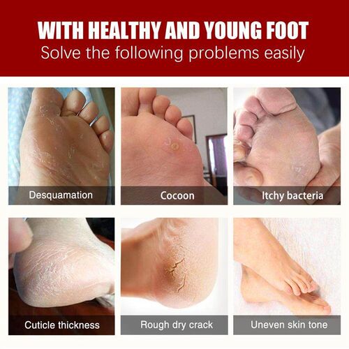 1Pair Exfoliating Foot Mask Film Exfoliation Scrub Remove De
