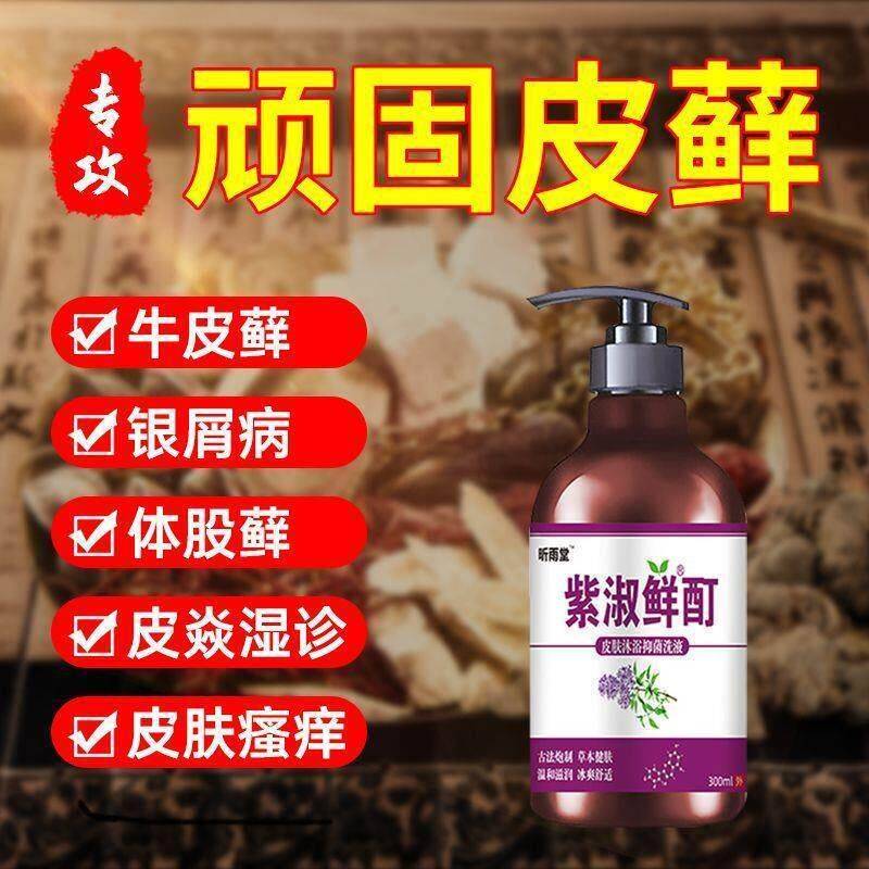 牛皮癣止痒沐露抗菌抑菌头清肤癣体股OTM癣湿银疹浴皮炎屑病特效