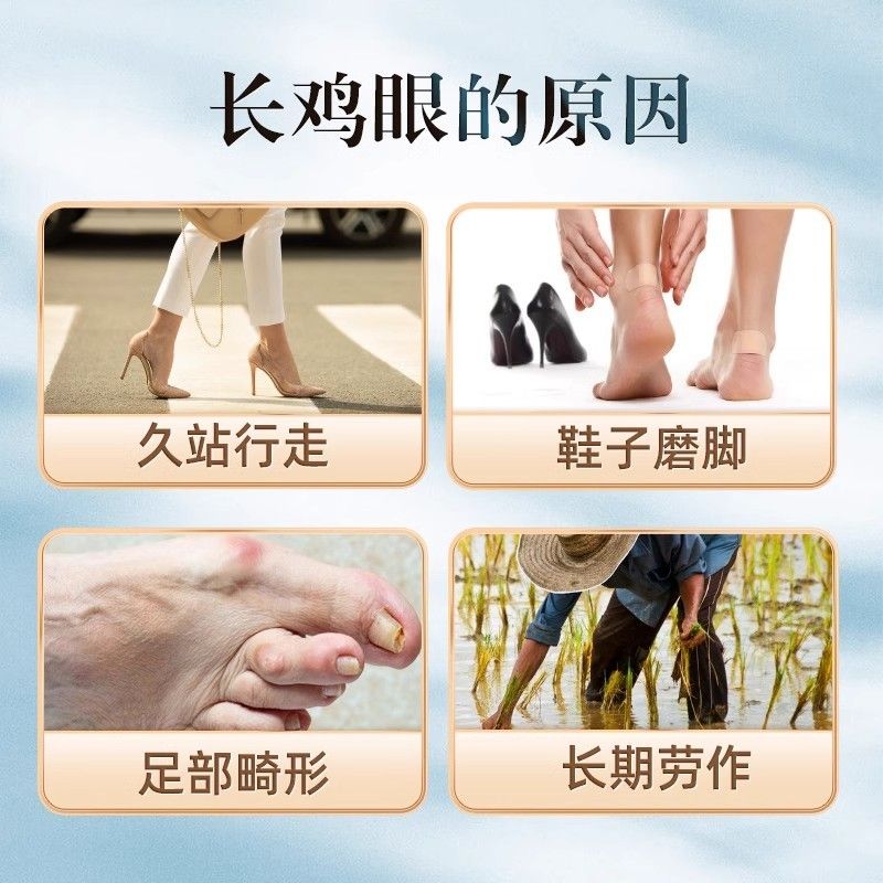 非北京同仁堂鸡贴尤去瘊599小肉粒扁平疣眼瘊药老茧跖疣脚底正品