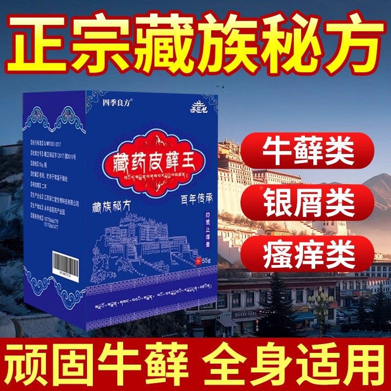 藏族皮藓王皮TKG膏头皮股银去药肤屑病皮杀菌牛症止痒抑菌正品专