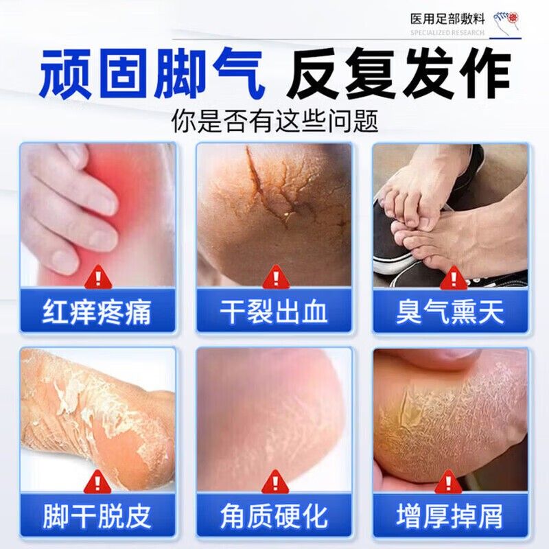 德国糜脚喷气雾剂痒脱皮杀脚RCG真菌感染烂脚丫烂脚趾止脚臭脚汗