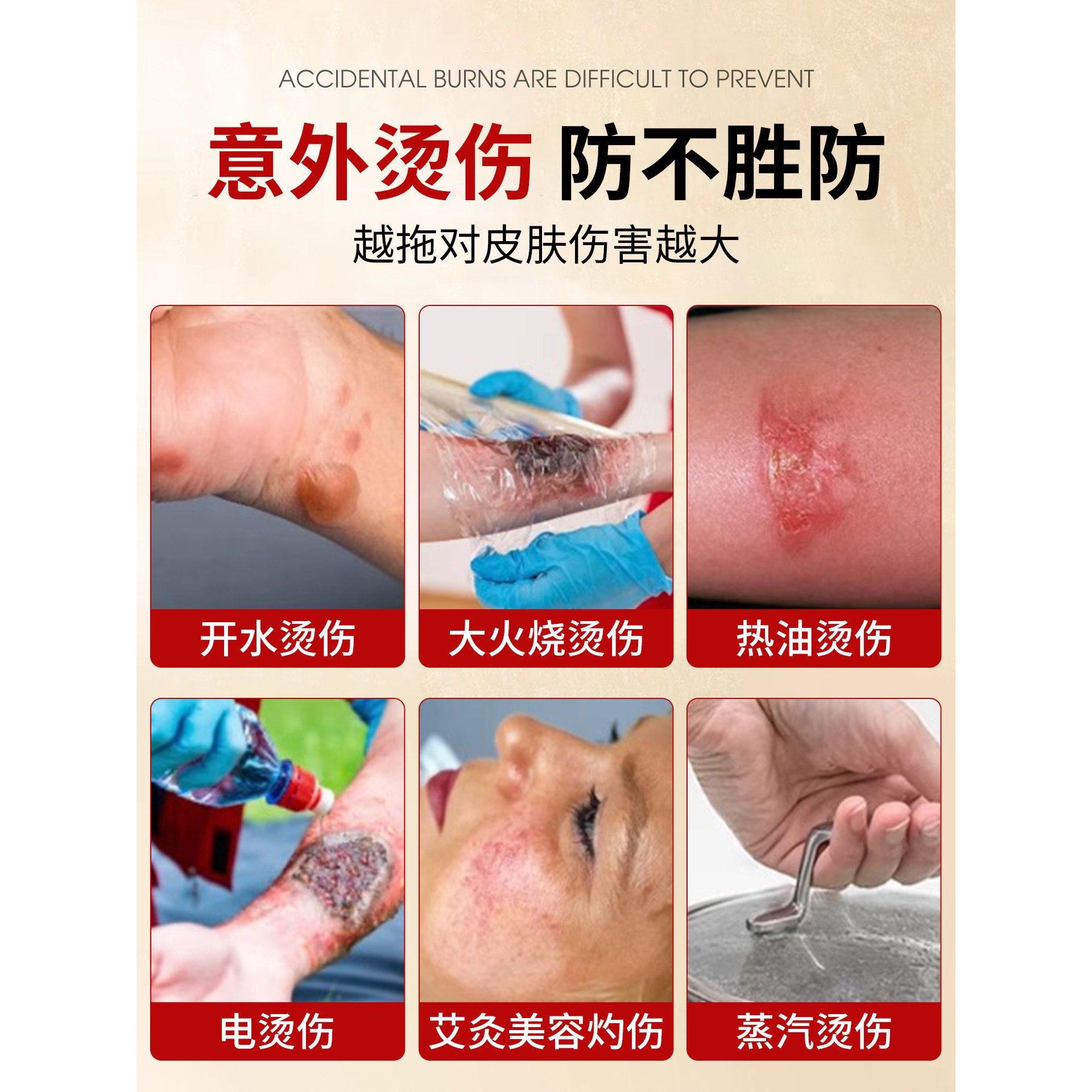 獾子油官方旗舰店正品NHB专搭润烧伤烫伤去祛疤膏医膏皮肤外用湿5