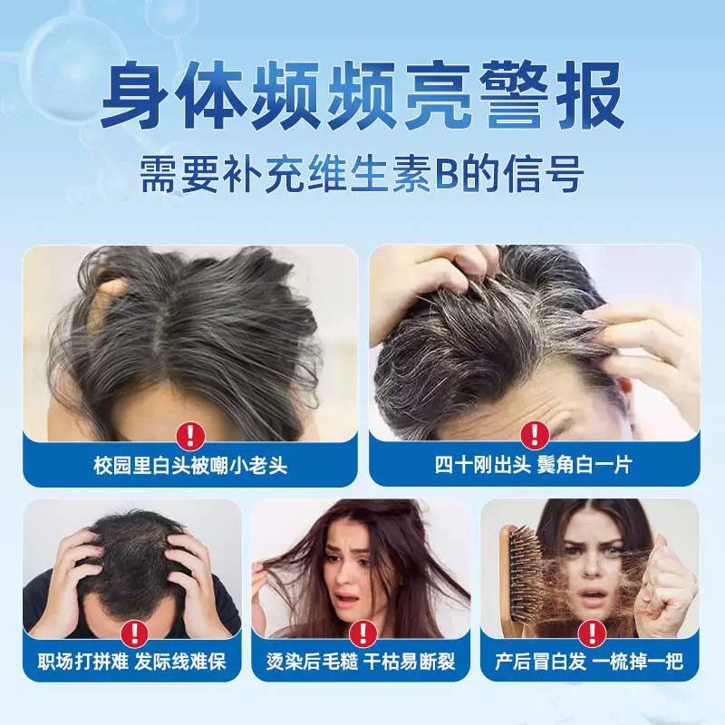 旗舰店】贝维NBS乐盈生维素B乌生方素多维片发护秀发中老年官正品