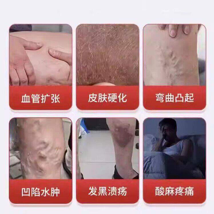 血舒缓片静脉护舒缓曲环UST张血液循舒缓片心管正品官方