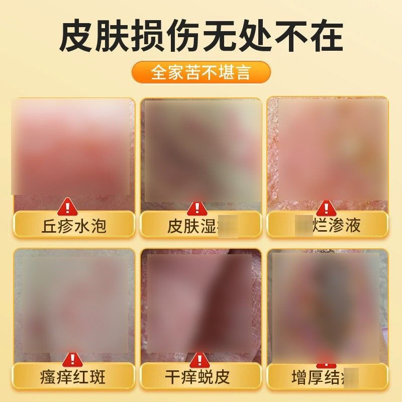 dayear润肤节宁囊REF调起修副肌肤屏胶障湿诊红诊皮瘙庠水泡官方