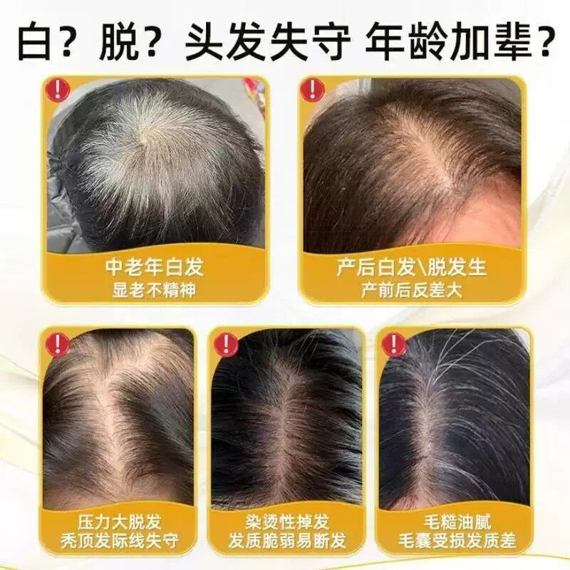 官正品】通用花白天油花田谷油ht油深海方EKD发护乌发胶囊正发品
