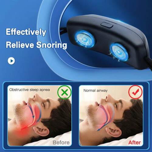 EMS Pulse Stop Snore Portable Comfortable Sleep Well Stop Sn