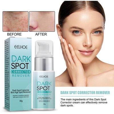 30g Dark Spot Remover Corrector Age Spot Freckle Removal Emu