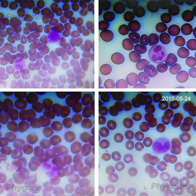 迪夫快速染色液 Diff Quik 细胞染色 排卵血液染色液体 PH1057