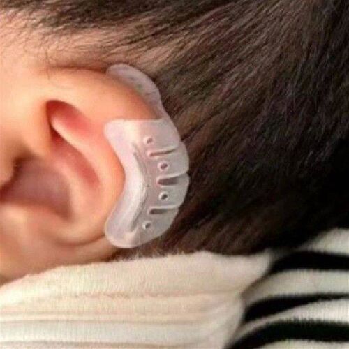 Protruding Ear Support Infant Corrector Tools Silicone