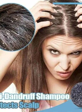2019Gray Hair Shampoo Bar 3pcs Moisturizing Bar Soap For Men