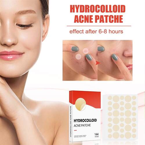 144pcs/set Face Men Women Skin Care Acne Pimple Patch 2