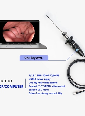 高清USB3.0内窥镜  采耳内窥设备
