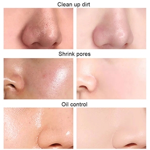 12/20pcs Mung Bean Face Cleansing Mud Peeling Acne Blackhead