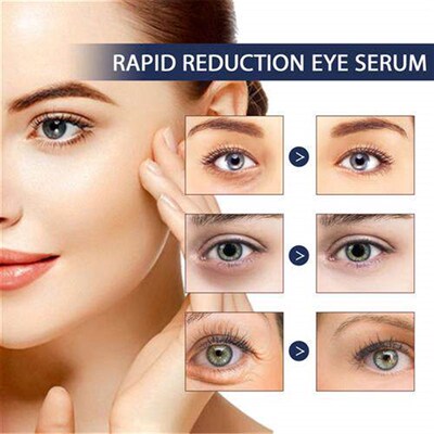The eye fixes the essence, the wet water desalinizes the ski