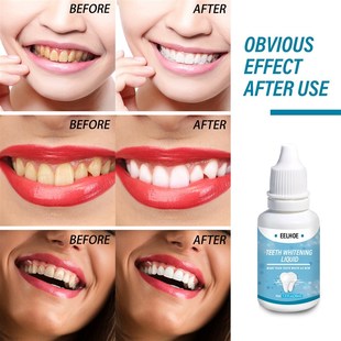 Teeth Whitening Essence Liqud Oral Hygiene Cleaning Whiten