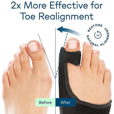 Orthopedic Bunion Splint Corrector Big Toe Separator Pain Re