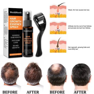 Hair growth essence spray main ingredienrs Anti- hair loss
