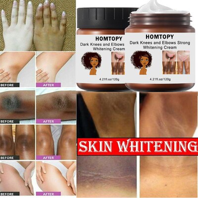 Dark Knees and Elbows Strong Whitening Cream