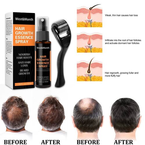 Hair growth essence spray main ingredienrs Anti- hair loss