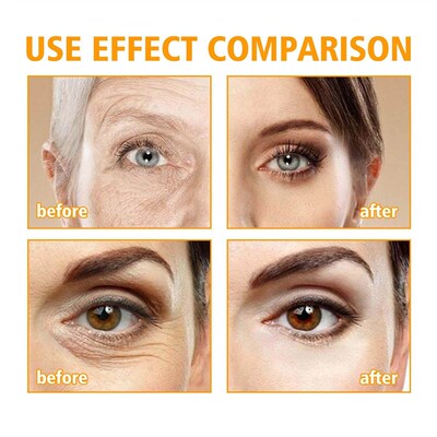 HOYGI 5D Peptide Eye Repair Cream - Fades fine lines and cro