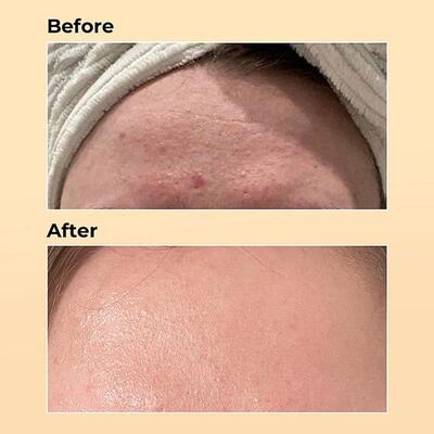 100ml COSRX Snail Mucin 96% Power Anti-aging Fade Fine Lines