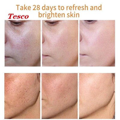 whitening freckle cream remove spots brighten Face Skin Care