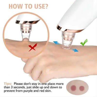 Newest Technology Blackhead Remover Vacuum Pore Cleaner for