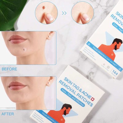 144pcs Skin Tags Moles Remover Patches Gift Wart Treatment