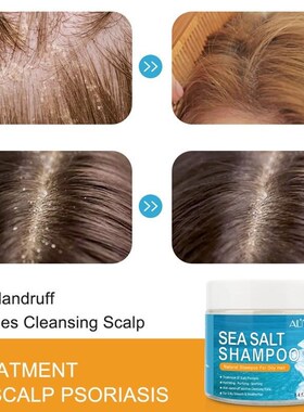Sea Salt Shampoo Hair Treatment Scalp Psoriasis海盐洗发膏水