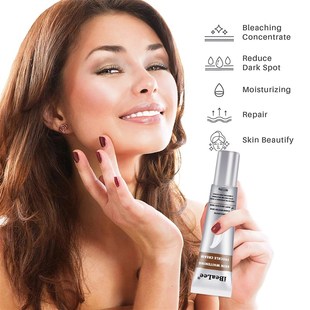 Whitening Freckle Cream Remove Melasma Cream Remove Dark Spo