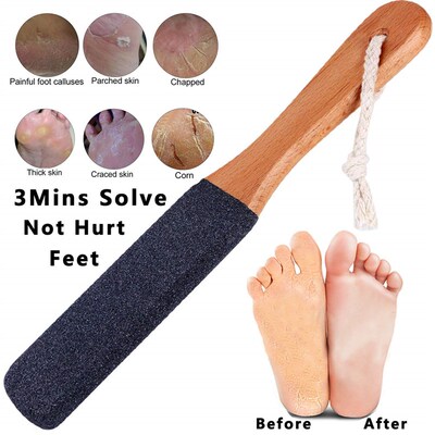 Foot File Callus Remover Scrubber Cracked Heels Dead Skin