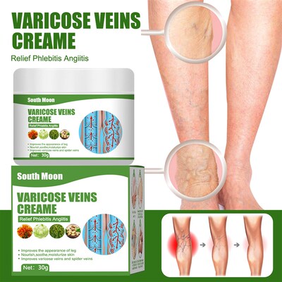 Varicose Veins Relief Cream Vasculitis Phlebitis Spider Leg