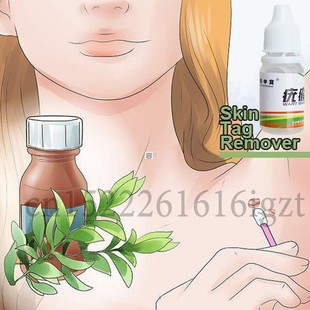 Skin Tag Mole Wart Remover Eye Skin Tag Remover 12 Hours