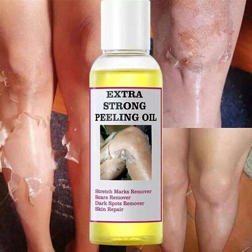 30/110ml Peeling Oil Elbow Knee Finger Black Yellow Oil For