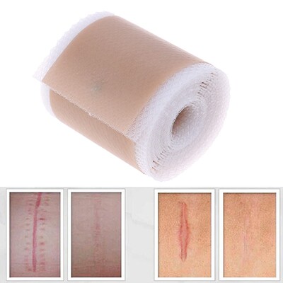4x150cm Efficient Surgery Scar Removal Silicone Gel Sheet Th