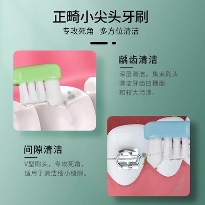 Orthodontic Toothbrush Teeth Braces Teeth Flattening Soft Ha