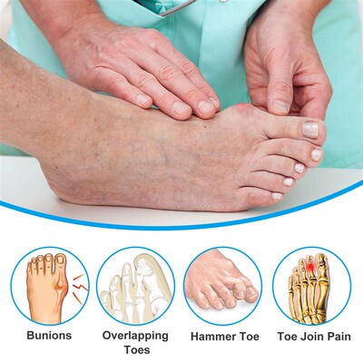 8pcs Soft Silicone Gel Toe Separator Hallux Valgus Bunion Co
