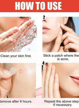 144pcs/set Face Skin Care Acne Pimple Patch 2 Sizes Invisibl