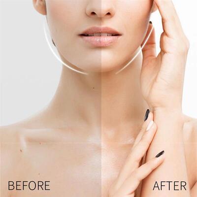 120Pcs V-Shape Face Wrinkle Sagging Skin Adhesive Tape Lifti