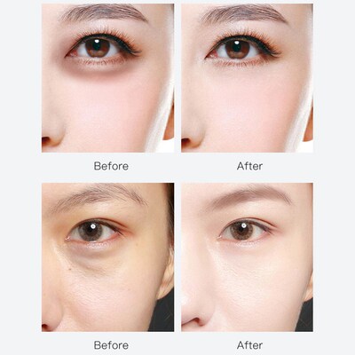 60 Pieces Of Eye Mask Hyaluronic Acid/amino Acid Moisturizin