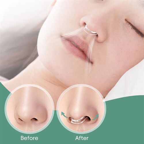 Snore Stopper Nasal Dilator for Snore Reduction Increases Ai