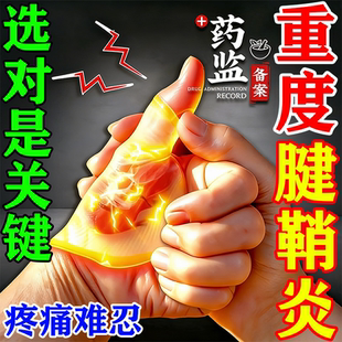 专治大拇指腱鞘炎的否药热敷贴中指腱鞘炎手指关节疼痛专用膏药贴