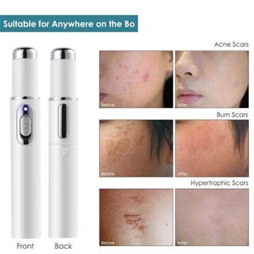 Blue light acne removal pen acne scar waterproof