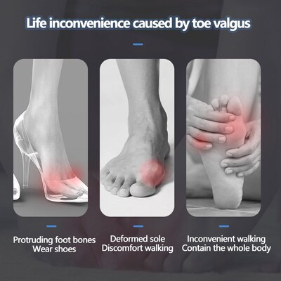 2/4pcs Purple Silicone Toe Separator Hallux Bone Corrector S