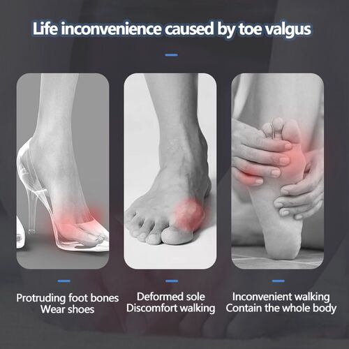 2/4pcs Purple Silicone Toe Separator Hallux Bone Corrector S