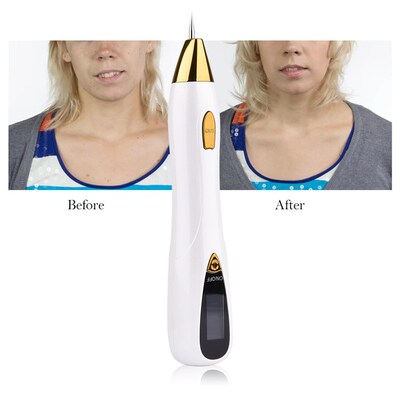 Laser Mole Removal Pen Wart Plasma Remover Tool Beauty Skin