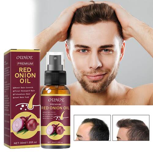 Ginger Hair Growth Essential Oil Fast Grow Anti Hair Loss Pr