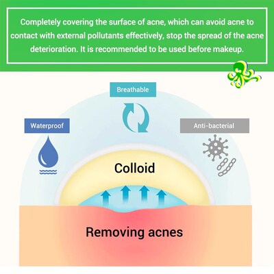 Acne Pimple Patch  Stickers Acne Treatment Pimple Remover To