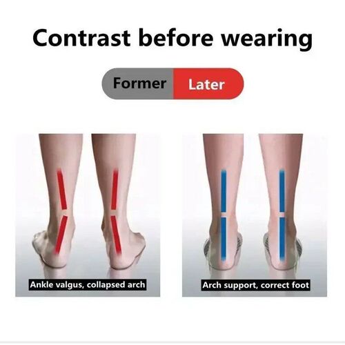 2 Pc EVA Flat Feet Arch Support Orthopedic Inole Pad for Sho
